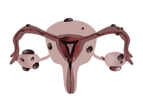 uterus